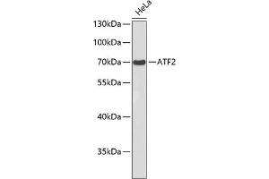 Western blot analysis of extracts of HeLa cells, using  antibody . (ATF2 抗体)