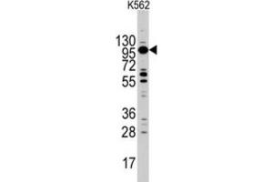 Western Blotting (WB) image for anti-Myosin ID (MYO1D) antibody (ABIN3002631) (Myosin ID 抗体)