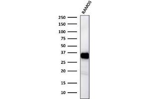 Western Blot Analysis of Ramos cell lysates using HLA-DR Mouse Monoclonal Antibody (TAL 1B5). (HLA-DR 抗体)