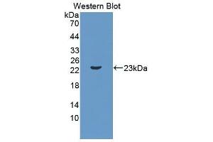 Western Blotting (WB) image for anti-Interleukin 11 (IL11) (AA 25-199) antibody (ABIN1862718) (IL-11 抗体  (AA 25-199))