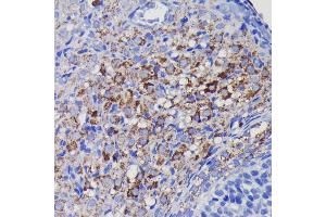 Immunohistochemistry of paraffin-embedded rat ovary using SOD2 antibody (ABIN7270638) at dilution of 1:100 (40x lens). (SOD2 抗体)