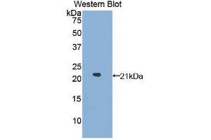 Western Blotting (WB) image for anti-Glucosidase, Alpha, Acid (GAA) (AA 595-770) antibody (ABIN1858936) (GAA 抗体  (AA 595-770))