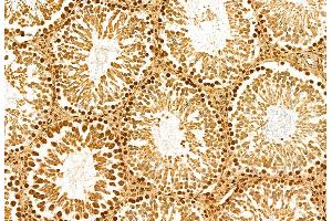 ABIN6263746 and ABIN6272947 at 1/100 staining Rat testis tissue by IHC-P. (NSUN2 抗体  (Internal Region))