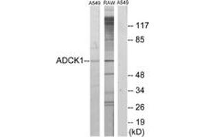 Western blot analysis of extracts from A549/RAW264. (ADCK1 抗体  (AA 251-300))