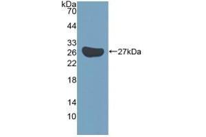 Detection of Recombinant KATNA1, Mouse using Polyclonal Antibody to Katanin P60 Subunit A 1 (KATNA1) (KATNA1 抗体  (AA 260-491))