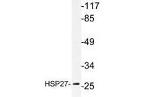 Western blot analyzes of HSP27 antibody in extracts from Jurkat cells. (HSP27 抗体)
