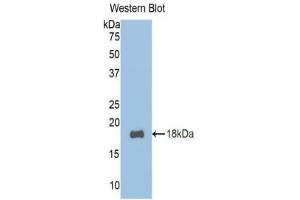 Western blot analysis of the recombinant protein. (TCF20 抗体  (AA 392-524))