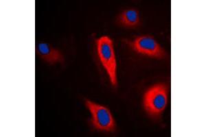 Immunofluorescent analysis of PLA2G4A staining in HeLa cells. (PLA2G4A 抗体  (Center))
