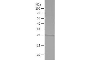 Involucrin Protein (IVL) (AA 408-543) (His tag)