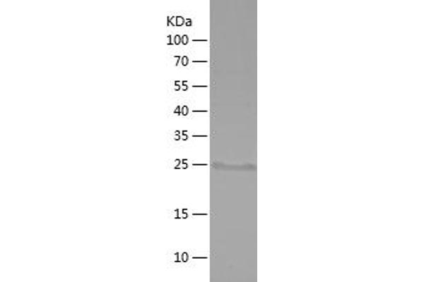 Involucrin Protein (IVL) (AA 408-543) (His tag)