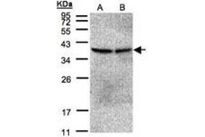 Image no. 1 for anti-Protein Phosphatase 2, Catalytic Subunit, beta Isozyme (PPP2CB) (AA 134-291) antibody (ABIN467440) (PPP2CB 抗体  (AA 134-291))