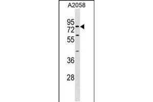 Western blot analysis in A2058 cell line lysates (35ug/lane). (SYT16 抗体  (AA 297-325))