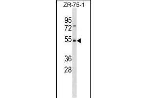 Western blot analysis in ZR-75-1 cell line lysates (35ug/lane). (FBXW4 抗体  (C-Term))