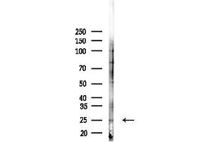 anti-Chromosome 18 Open Reading Frame 55 (C18orf55) (Internal Region) antibody