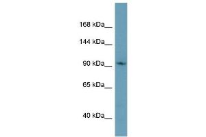 Western Blotting (WB) image for anti-Cap Methyltransferase 1 (CMTR1) (C-Term) antibody (ABIN2786076) (CMTR1 抗体  (C-Term))