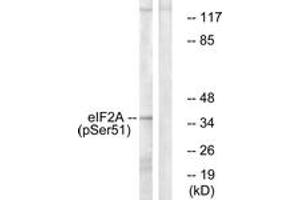 Western blot analysis of extracts from K562 cells treated with IFN-alpha 1000U/ml 18h, using eIF2 alpha (Phospho-Ser51) Antibody.