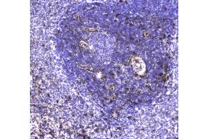 IHC analysis of S100A10 using anti-S100A10 antibody . (S100A10 抗体  (AA 4-94))