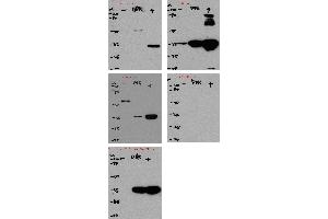 Immunoprecipitating Flag Tag in 293F transfected whole cell lysate Lane 1: Mouse control IgG instead of  in Flag Tag in 293F transfected whole cell lysate. (DYKDDDDK Tag 抗体)