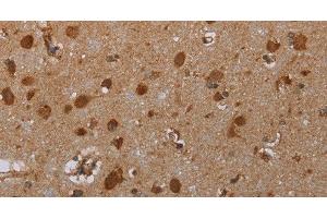 Immunohistochemistry of paraffin-embedded Human brain tissue using ATP2A1 Polyclonal Antibody at dilution 1:30 (ATP2A1/SERCA1 抗体)