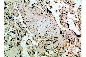 Immunohistochemical analysis of paraffin-embedded human-placenta, antibody was diluted at 1:200 (FLT4 抗体  (AA 640-700))