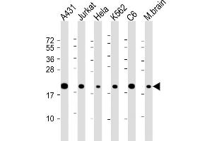 All lanes : Anti-RPS10 Antibody (C-Term) at 1:2000 dilution Lane 1: A431 whole cell lysate Lane 2: Jurkat whole cell lysate Lane 3: Hela whole cell lysate Lane 4: K562 whole cell lysate Lane 5: C6 whole cell lysate Lane 6: mouse brain lysate Lysates/proteins at 20 μg per lane. (RPS10 抗体  (AA 96-129))