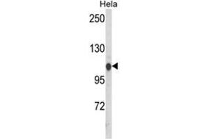 Western blot analysis of HSPA4L Antibody (C-term) in Hela cell line lysates (35ug/lane). (HSPA4L 抗体  (C-Term))