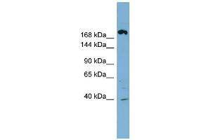 WB Suggested Anti-ABCC11 Antibody Titration:  0. (ABCC11 抗体  (Middle Region))