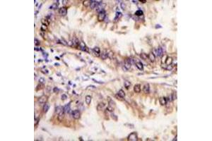 Image no. 3 for anti-serine threonine Kinase 39 (STK39) (C-Term) antibody (ABIN356942) (STK39 抗体  (C-Term))