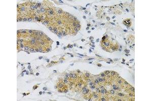 Immunohistochemistry of paraffin-embedded Human stomach using PTPRA Polyclonal Antibody at dilution of 1:100 (40x lens). (PTPRA 抗体)