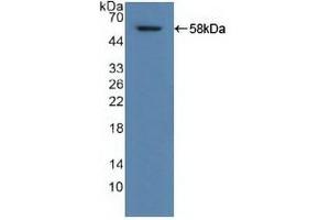Detection of Recombinant ALDH1A1, Human using Polyclonal Antibody to Aldehyde Dehydrogenase 1 Family, Member A1 (ALDH1A1) (ALDH1A1 抗体  (AA 2-501))