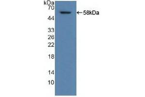 Detection of Recombinant ALDH1A1, Human using Polyclonal Antibody to Aldehyde Dehydrogenase 1 Family, Member A1 (ALDH1A1) (ALDH1A1 抗体  (AA 2-501))