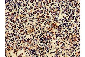 IHC image of ABIN7145448 diluted at 1:700 and staining in paraffin-embedded human spleen tissue performed on a Leica BondTM system.