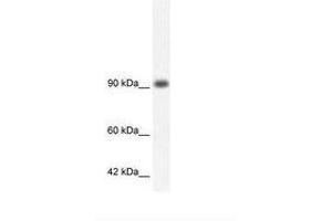 Image no. 3 for anti-RNA Binding Motif Protein 10 (RBM10) (AA 79-128) antibody (ABIN202953) (RBM10 抗体  (AA 79-128))