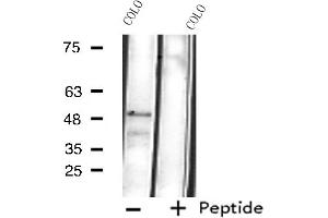 Western blot analysis of extracts from COLO cells, using Cytochrome P450 4B1 antibody.