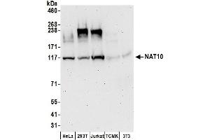 Western Blotting (WB) image for anti-N-Acetyltransferase 10 (GCN5-Related) (NAT10) (AA 650-700) antibody (ABIN7455028)