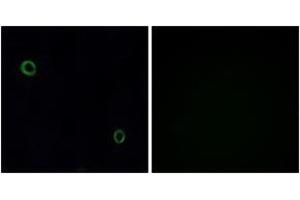 Immunofluorescence analysis of A549 cells, using CXCR4 Antibody. (CXCR4 抗体  (AA 300-349))