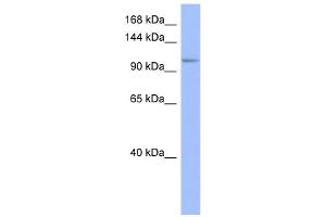 WB Suggested Anti-MSH4 Antibody Titration:  0. (MSH4 抗体  (Middle Region))