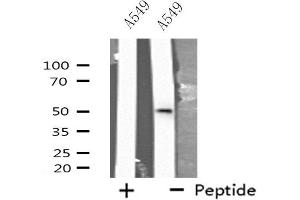Western blot analysis of extracts from A549 cells, using CXG2 antibody. (GJC2 抗体  (N-Term))