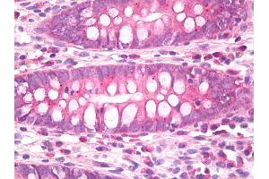 Anti-CB1 antibody IHC of human colon. (CNR1 抗体)