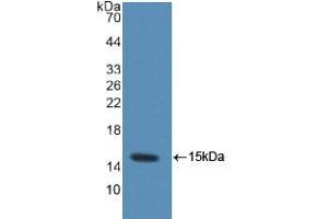 Western blot analysis of recombinant Rat MRP1. (MRP1 抗体  (AA 21-115))
