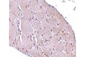 Immunohistochemistry (IHC) image for anti-Wingless-Type MMTV Integration Site Family, Member 10A (WNT10A) (C-Term) antibody (ABIN1030803) (WNT10A 抗体  (C-Term))