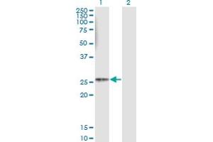 Western Blot analysis of HLA-DMB expression in transfected 293T cell line by HLA-DMB monoclonal antibody (M08), clone 4D12. (HLA-DMB 抗体  (AA 22-129))