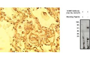 Image no. 1 for anti-Numb Homolog (NUMB) antibody (ABIN793714) (NUMB 抗体)