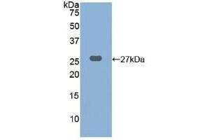 Detection of Recombinant CTSK, Human using Polyclonal Antibody to Cathepsin K (CTSK)