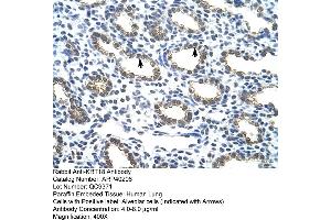 Rabbit Anti-KRT18 Antibody  Paraffin Embedded Tissue: Human Lung Cellular Data: Alveolar cells Antibody Concentration: 4. (Cytokeratin 18 抗体  (C-Term))