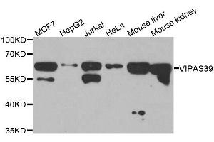 Western blot analysis of extracts of various cell lines, using VIPAS39 antibody. (VIPAR 抗体  (AA 1-220))