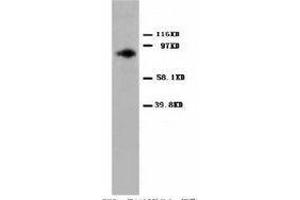 Image no. 2 for anti-Protein Kinase C, alpha (PKCa) (C-Term) antibody (ABIN1492930) (PKC alpha 抗体  (C-Term))