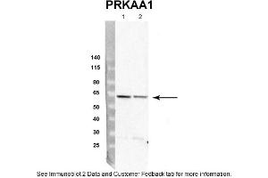 Western Blotting (WB) image for anti-Protein Kinase, AMP-Activated, alpha 1 Catalytic Subunit (PRKAA1) (Middle Region) antibody (ABIN2785500)