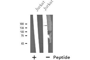 Western blot analysis of extracts from Jurkat cells, using NCAN antibody. (Neurocan 抗体  (Internal Region))