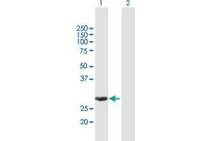 Western Blot analysis of MMS19 expression in transfected 293T cell line by MMS19 MaxPab polyclonal antibody.